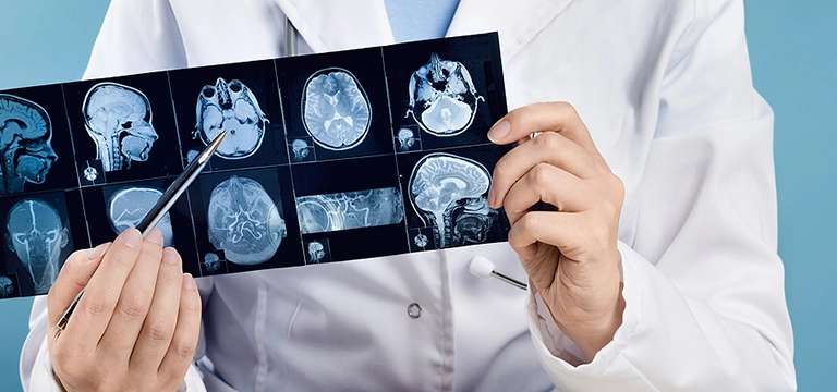 MRI Brain for Traumatic Brain Injury